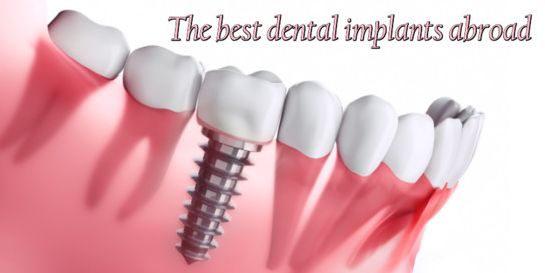Tooth implants overseas - Budapes, Hungary vs Turkey